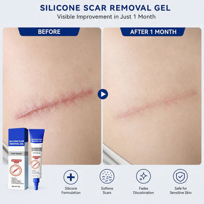 scar-removal-gel