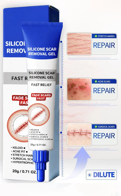 scar-removal-gel